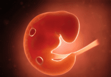 PS 504 error jurídico y político